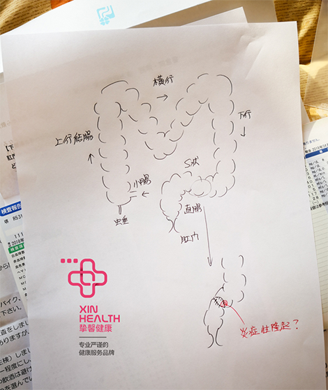 挚馨健康 XIN HEALTH 日本体检肠镜检查后 医生为用户细致图解说明检查结果
